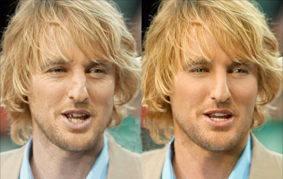 Retouches Owen Wilson