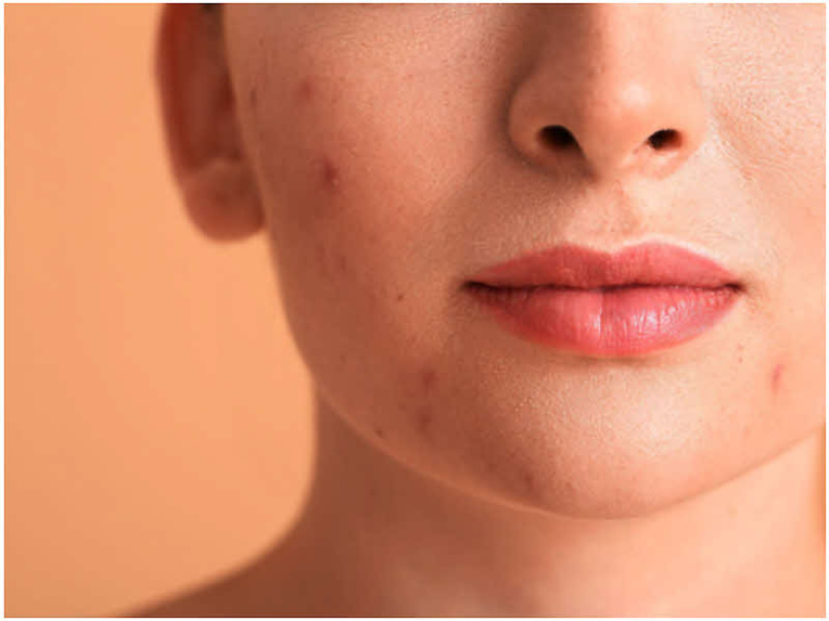 Snoflore / Pixel-Shot©/AdobeStock. Snoflore / Pixel-Shot©/AdobeStock.