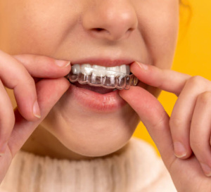 Comment corriger la béance dentaire chez les adultes ?